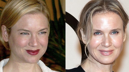 Renée Zellweger. 