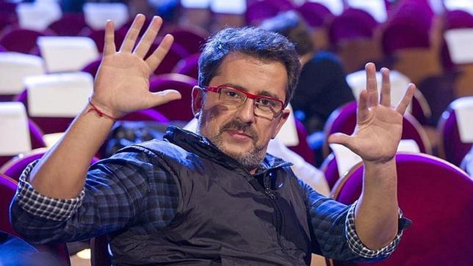 Famosos que usan injertos en el pelo