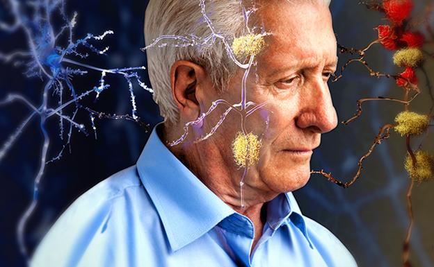Un descubrimiento puede ayudar a revertir la pérdida de memoria en el Alzheimer 