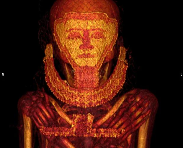Un estudio de la UJA halla en una momia el cáncer de mama más antiguo del mundo