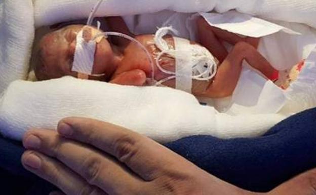 El milagro del bebé que ha sobrevive tras pesar 400 gramos al nacer