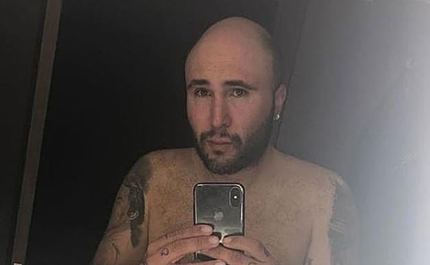 Desvelan los detalles del informe médico de Kiko Rivera: ¿Qué le pasa realmente?