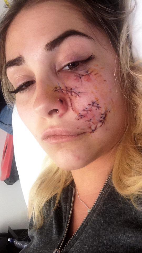 Fotos: El ataque de un perro a la famosa modelo Suzel Mackintosh