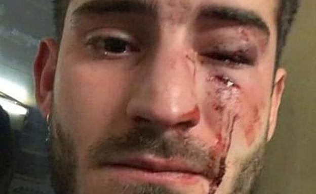 Imagen del joven jienense.