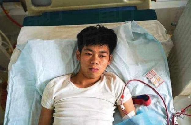 Un estudiante chino que hace ocho años vendió un riñón para comprar un móvil de alta gama vive postrado en una cama