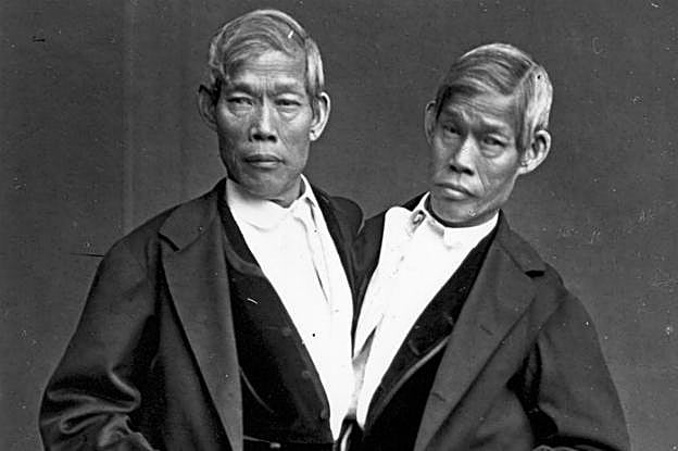 Los siameses Chang y Eng llegaron al mundo en 1811 y siguieron juntos hasta el final.