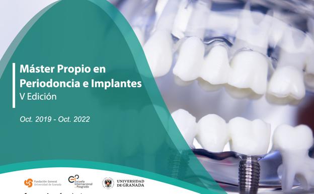 Periodoncia e implantes, una especialización de prestigio en la Universidad de Granada
