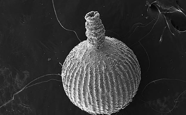 Imagen principal - Foraminífero bentónico, Gorgojo y Anisakis 