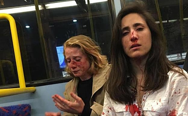 Melania Geymonat y su pareja, Chris, tras la agresión.