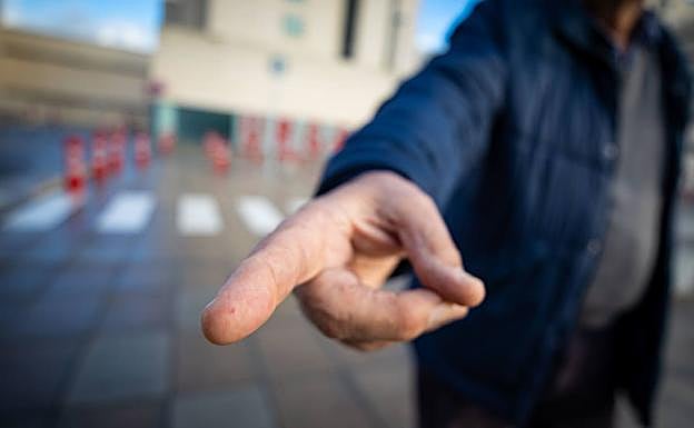 Ese diminuto punto rojo en la punta del dedo, una telangiectasia. 