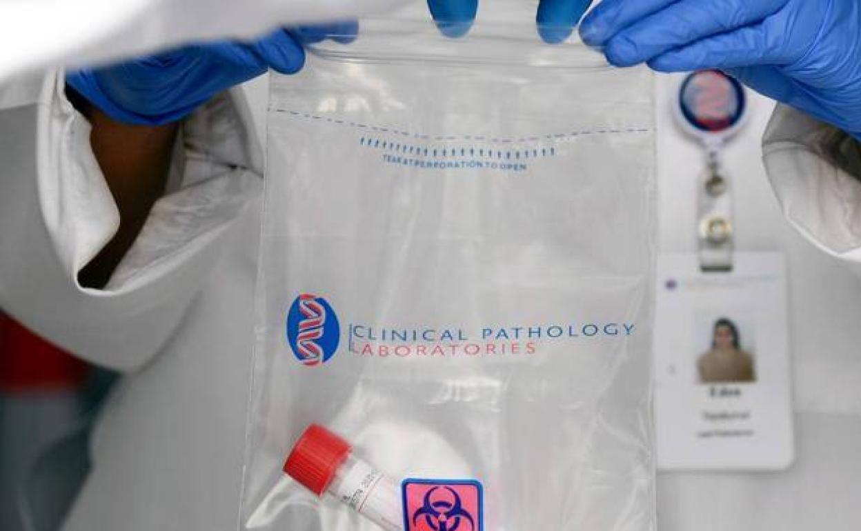 Fármaco contra el coroanvirus | Gilead se dispara en Bolsa por los resultados positivos del fármaco Remdesivir contra el Covid-19