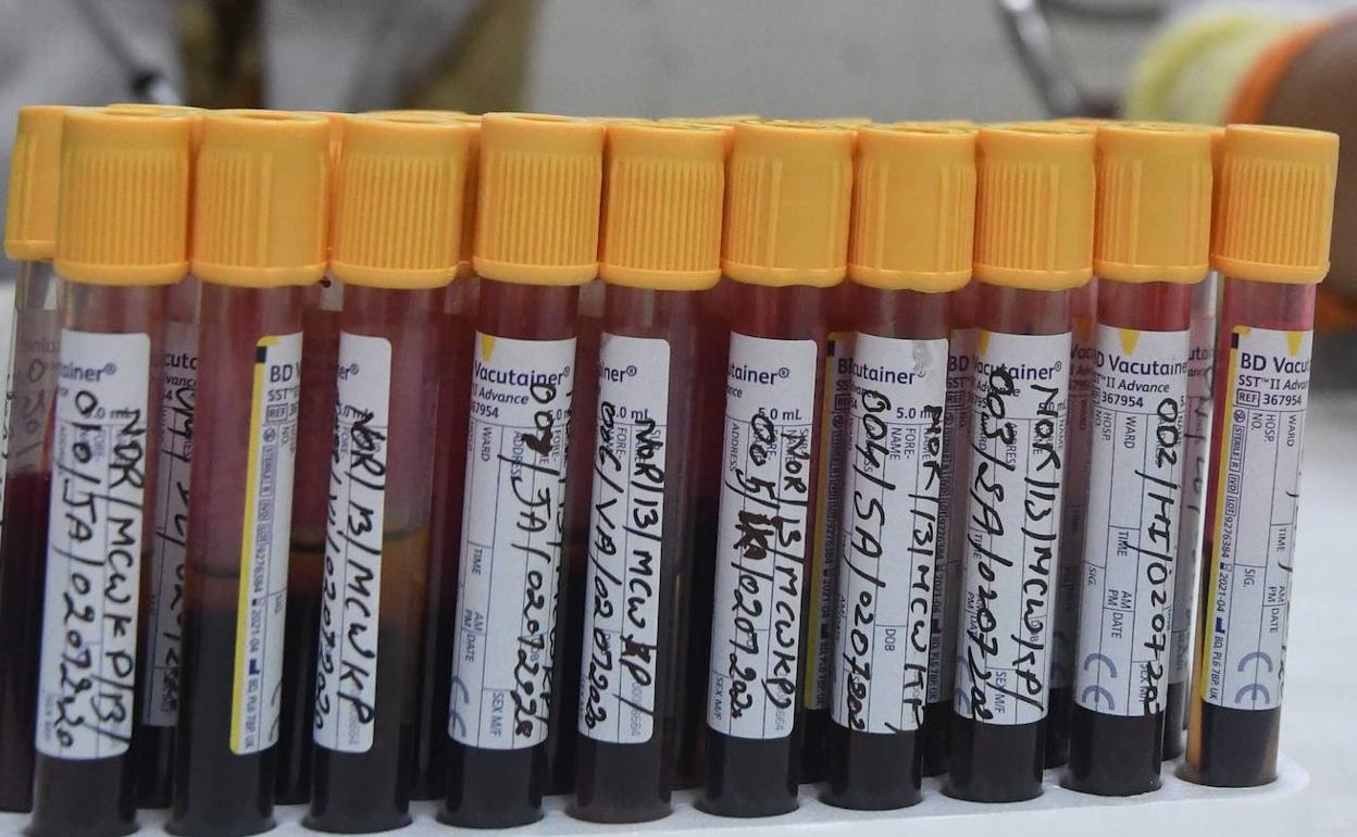 Exaltación de lo cercano