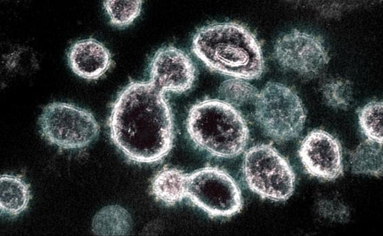 Imagen del coronavirus en un microoscopio.