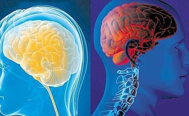 Un estudio descubre que la Covid llega al cerebro a través de la nariz y afecta al sistema nervioso