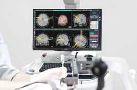 El robot para neurocirugía Kymero diseñado por Koh Young Technology y en el que se podrá integrar el nuevo escáner que se desarrolla en Granada, aunque también se podrá usar por separado.