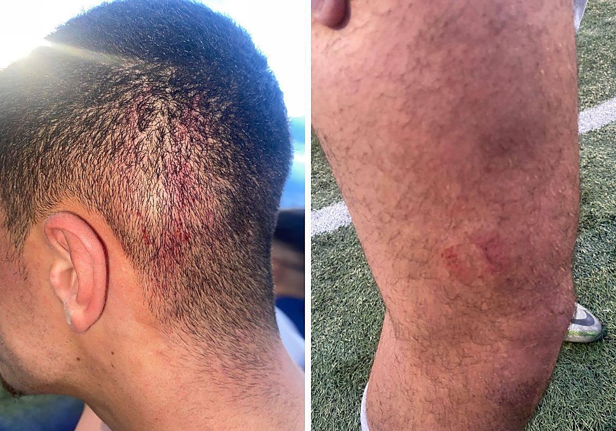 Un jugador del Puerto de Motril muerde y pisa la cabeza a un rival del Santa Fe