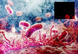 Cómo se contagia la salmonella: alimentos, síntomas y efectos