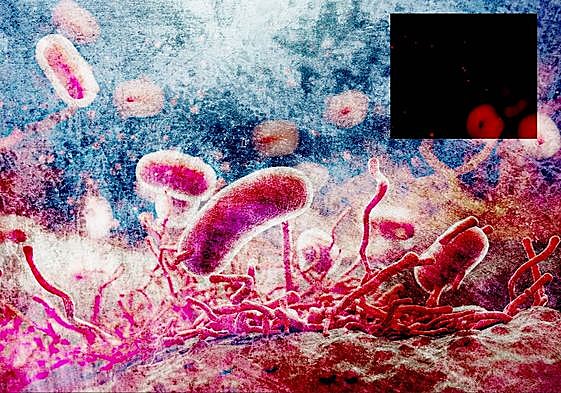 Cómo se contagia la salmonella: alimentos, síntomas y efectos