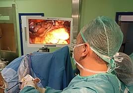 Ejemplo de la aplicación de esta nueva técnica.