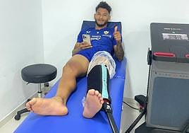 Luis Suárez ya ha comenzado su recuperación de la lesión en el peroné.