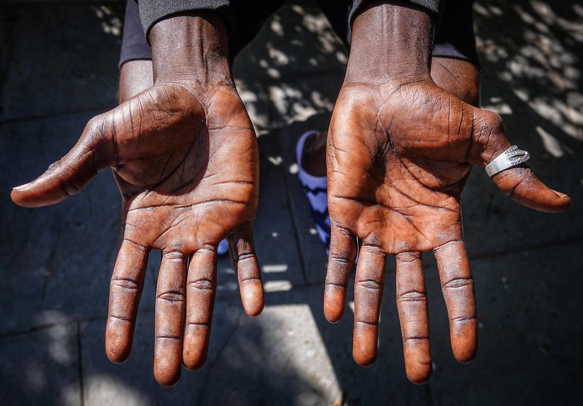 Las manos de Lamin, ajadas por el duro trabajo en la mar.