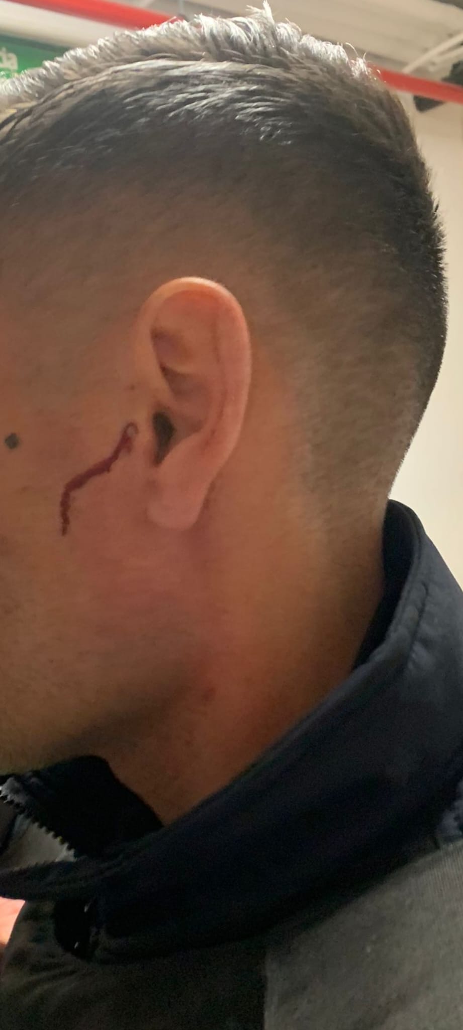 Otro de los agentes heridos por el agresor.