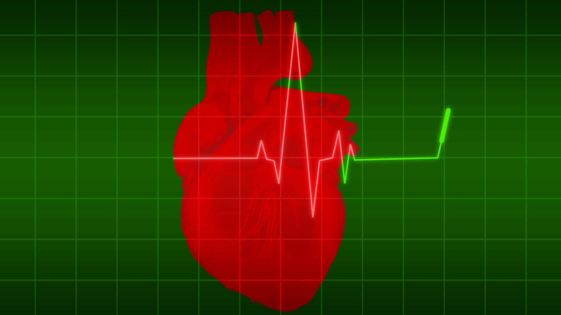 Las claves para usar un desfibrilador, paso a paso