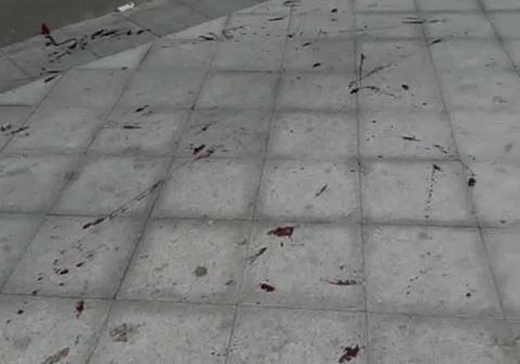 Reguero de sangre por la herida de bala.