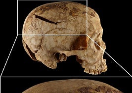 Calavera de una de las víctimas