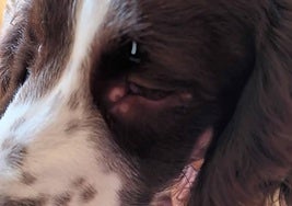 Lesiones presentadas por la paciente.