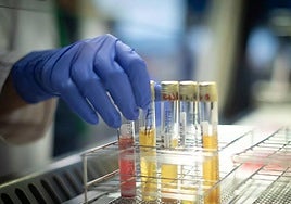 Vacuna contra la viruela del mono