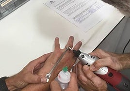 Bomberos retirando el anillo del dedo de la mujer.