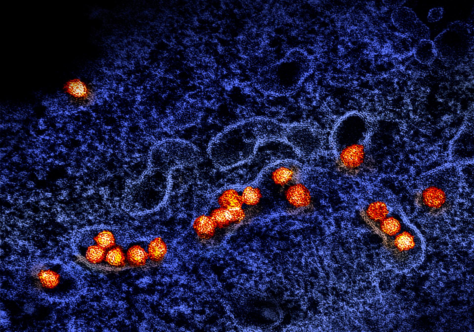 Imagen microscópica de las partículas del virus del Nilo Occidental (manchas naranjas) replicándose en el citoplasma de una célula.