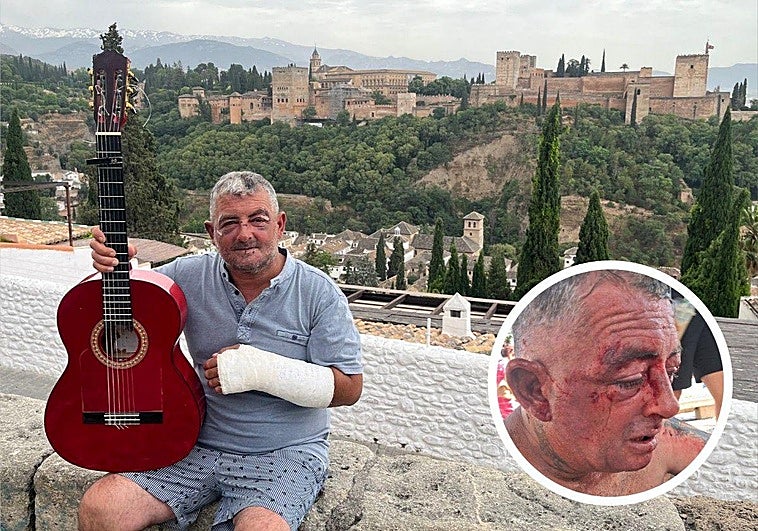 A la derecha, Agustín este martes en el mirador. A la derecha, justo después del ataque.