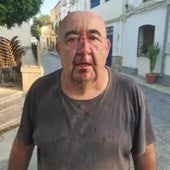 Rompen la nariz a un concejal de Alsodux tras atacarle con una piedra cuando conducía su coche