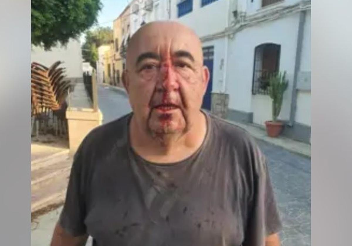Rompen la nariz a un concejal de Alsodux tras atacarle con una piedra cuando conducía su coche