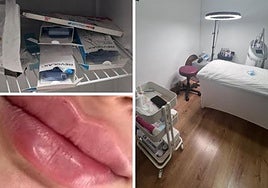 Imágenes de la clínica, los viales y los labios de una clienta publicados en Instagram.