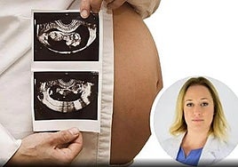 Estos son los alimentos que las embarazadas no pueden comer según una conocida ginecóloga