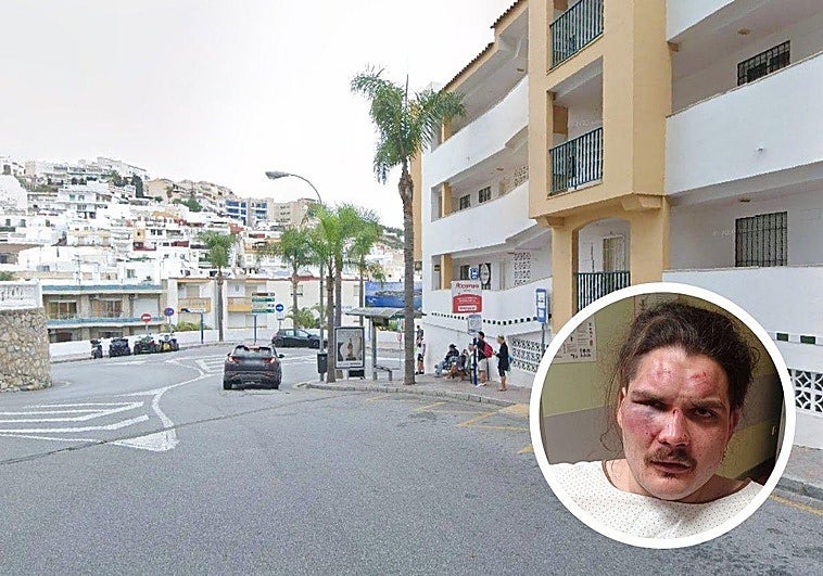 «Para mí ha sido un intento de asesinato, pero como no tenga algo roto, poco les va a caer; es una vergüenza»