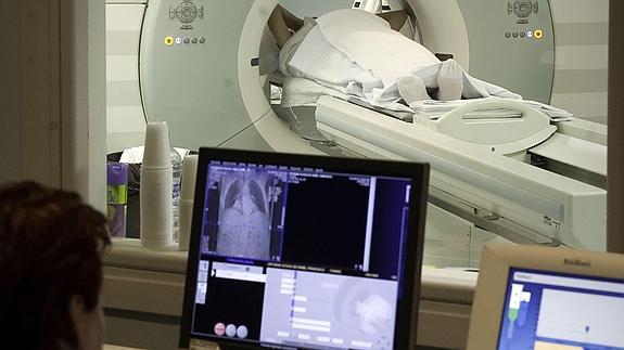 Los casos de cáncer aumentan un 12% en una década