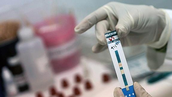 Un especialista sostiene una prueba del VIH.