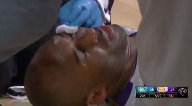 Le parten la ceja a Kobe Bryant y se la curan en pleno partido