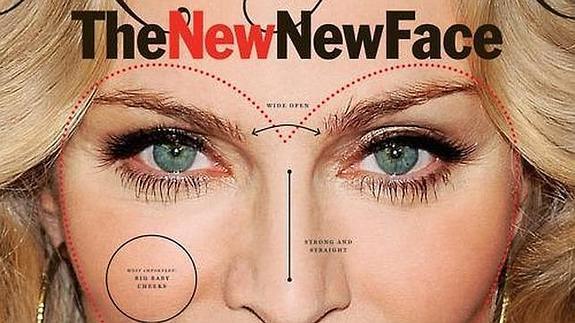 El 'barón del botox' y su mejor obra: la nueva cara de Madonna