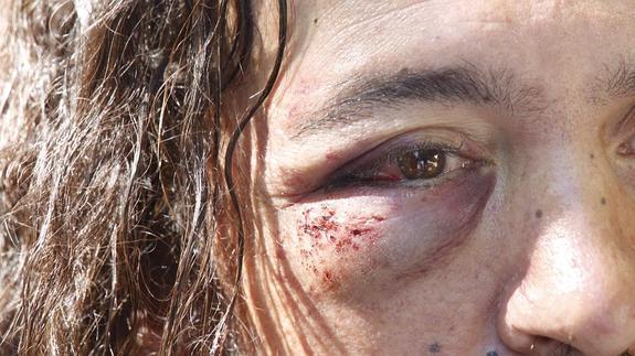 Así le ha quedado la cara a Marcos. 