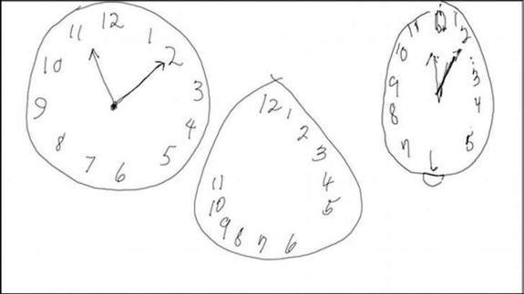 Tu forma de dibujar un reloj permite saber si sufrirás Alzheimer o Parkinson