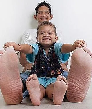 El hombre con el pie más grande del mundo: 40 centímetros | Ideal