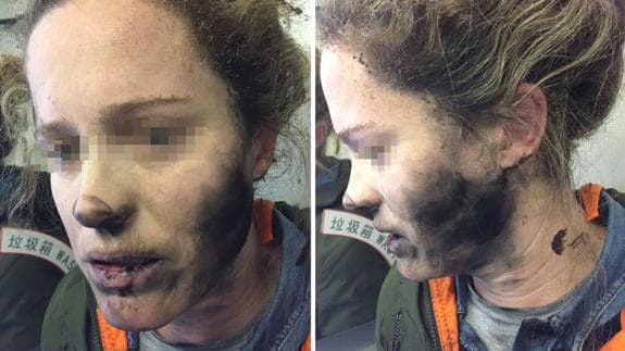 Una mujer se quema la cara tras incendiarse sus auriculares en pleno vuelo
