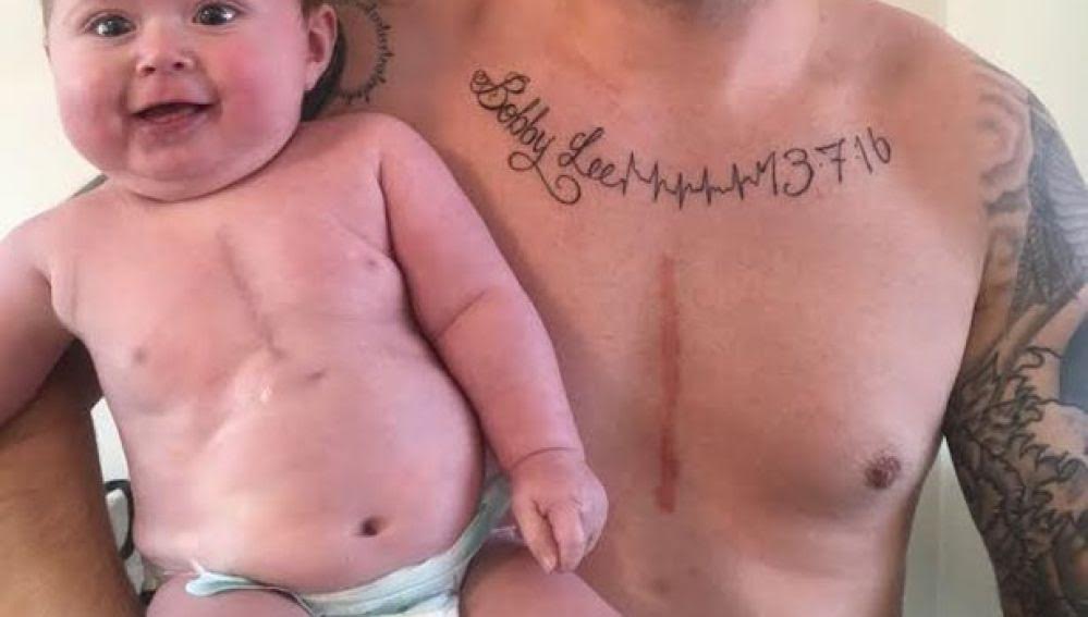 El emotivo gesto de un padre tras ser su hijo operado a corazón abierto