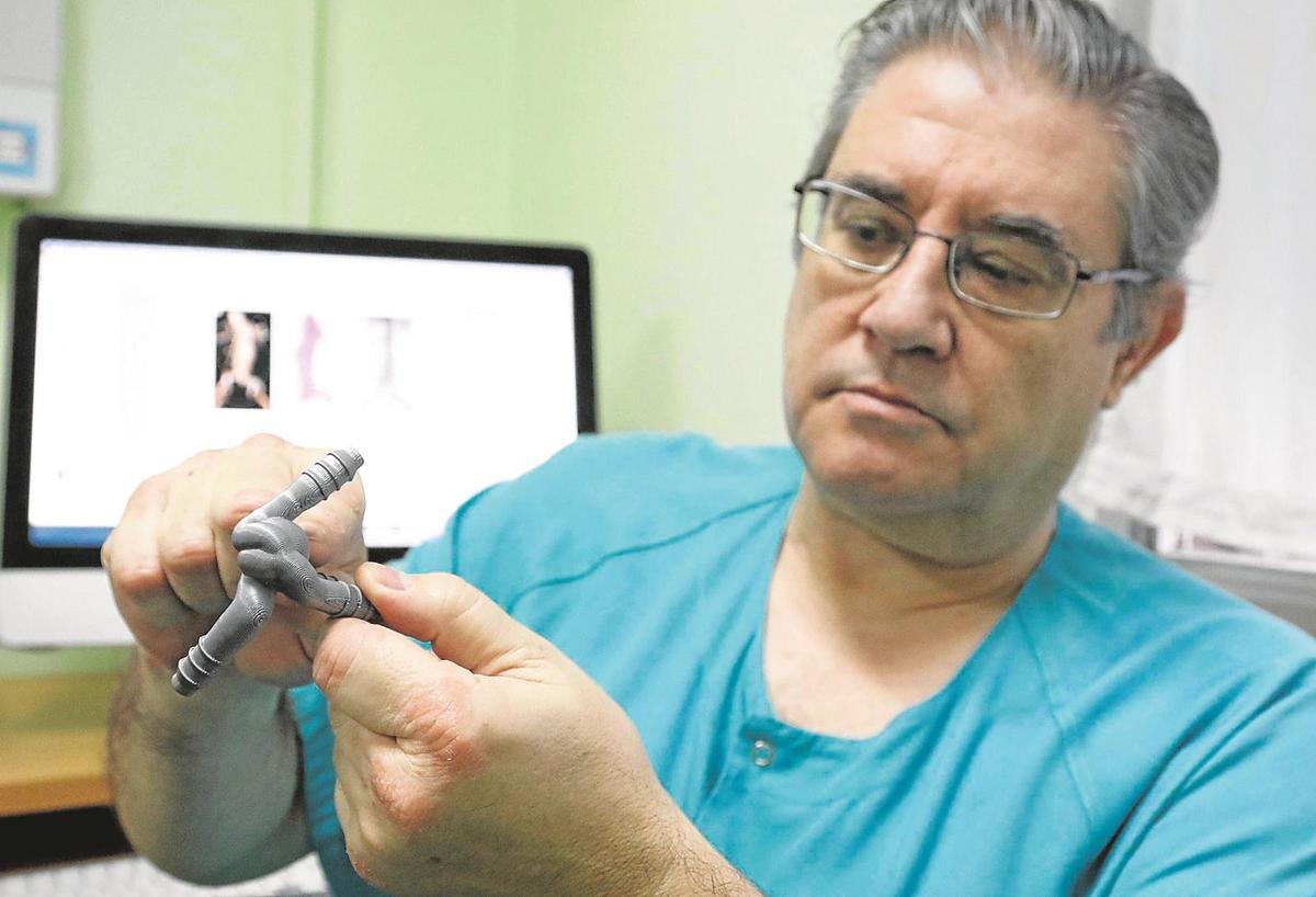 Francisco Lozano exhibe el molde de un aneurisma cerebral que se ha impreso en 3D, adaptado para ensayar la cirugía en un quirófano.
