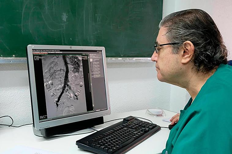 Francisco Lozano, jege del servicio de Cirugìa Vascular y Angiología, revisa el caso de un paciente.